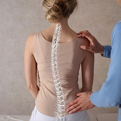 scoliosis